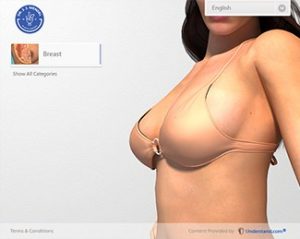 Breast Augmentation Patient Education