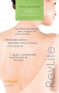 Cynosure RevLite Tattoo Treatment