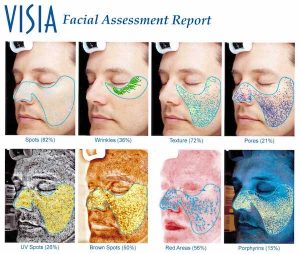 Visia Skin Care