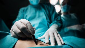 photo of doctor wearing scrubs face mask gloves marking where incision will go on patient