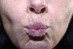 Close-up of middle aged woman puckering her lips