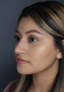 side profile of woman's face after liquid rhinoplasty