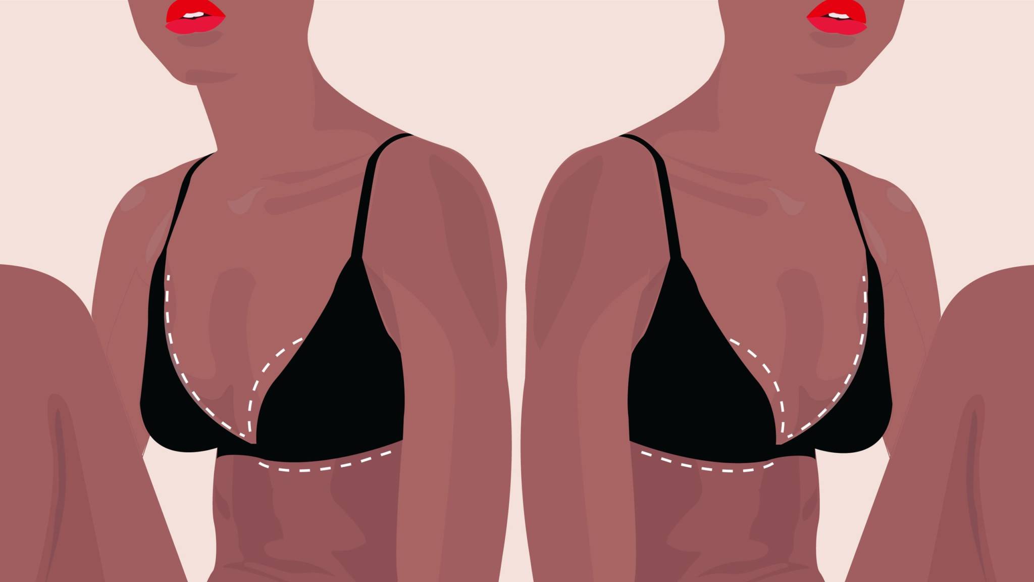 breast reduction graphic of woman in bra