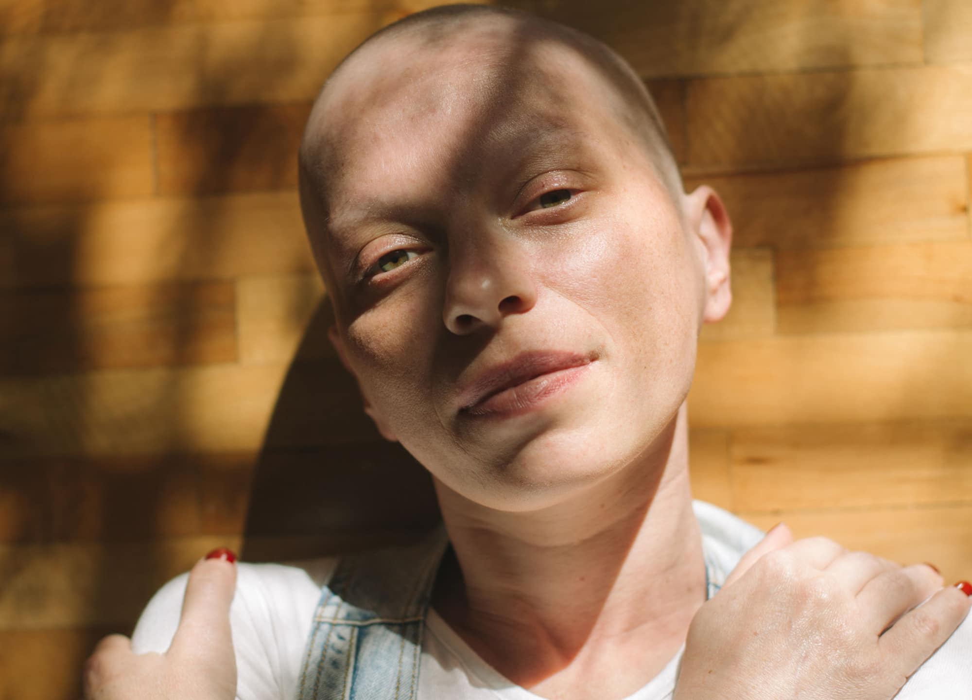 woman with cancer standing in the shadows