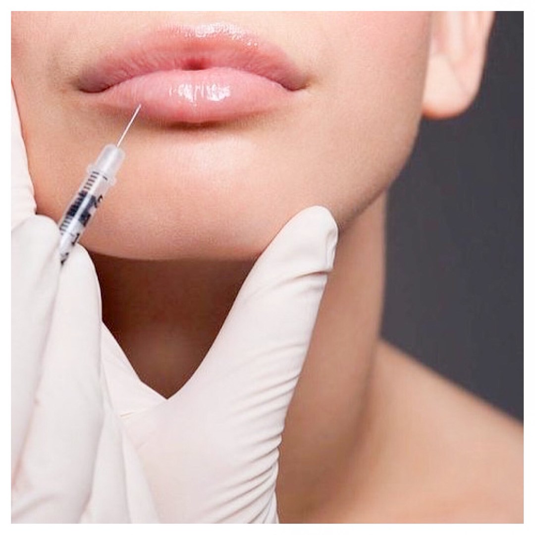 Caucasian woman receiving lip injections by a professional wearing medical gloves