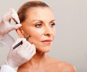 Facelift Nashville
