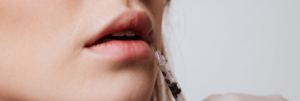 Caucasian woman receiving lip injections