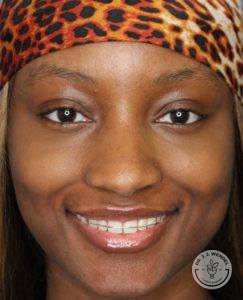Close-up of a black woman smiling with retainer and cheetah print headband