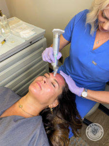 woman receiving microneedling treatment
