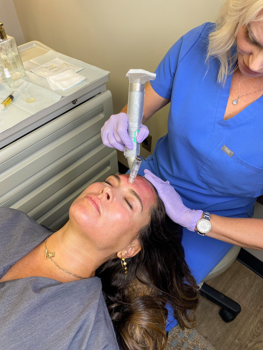 woman receiving microneedling treatment