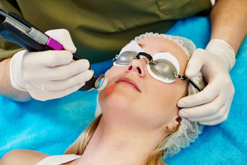 woman recieving laser treatment on face