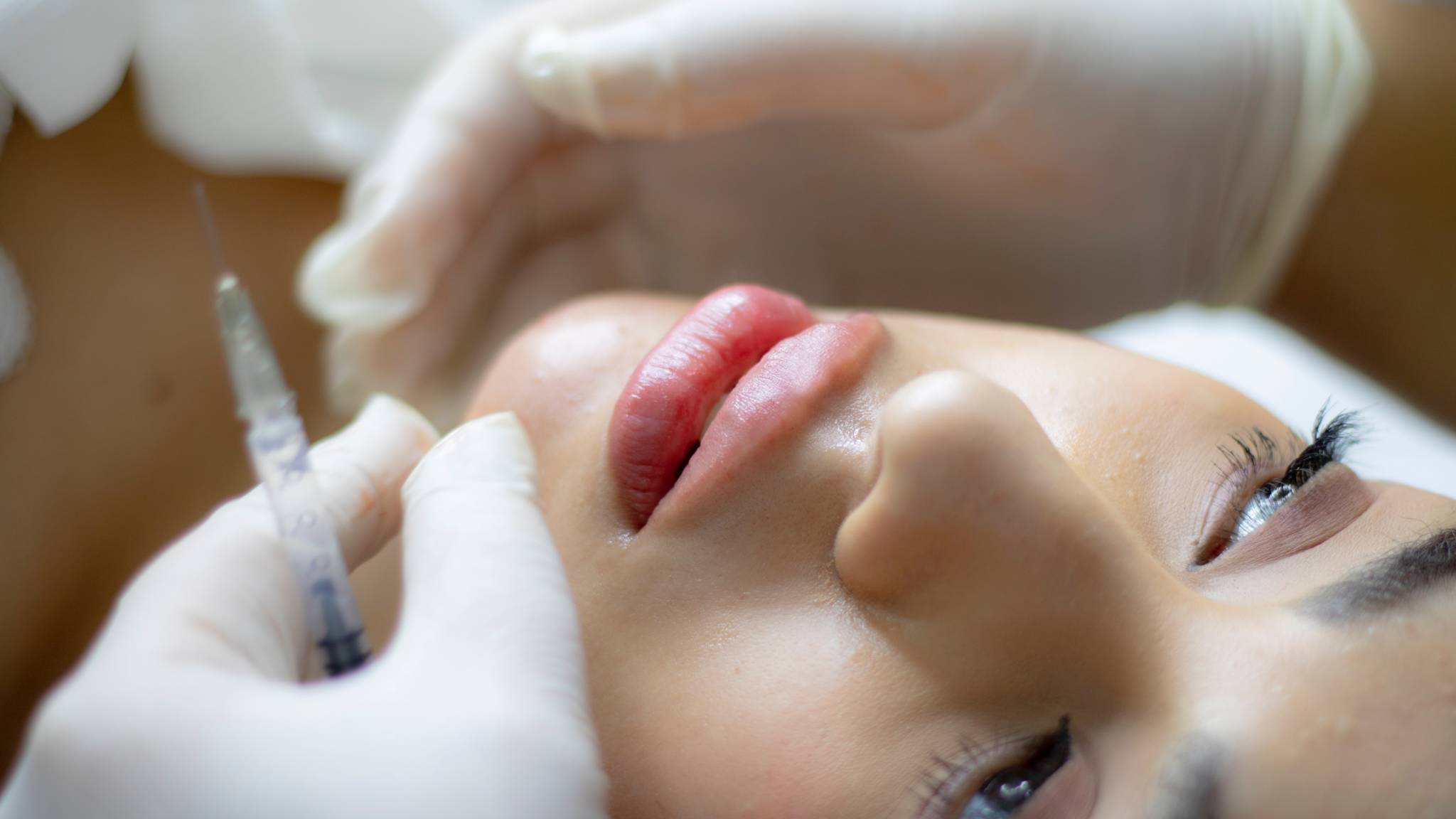 womans face laying down and person with white gloves injecting dermal filler in face