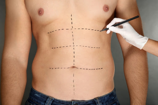 man's torso with dashed lines on abdomen