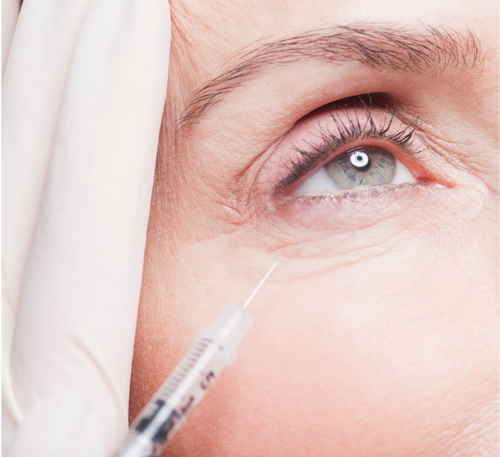 Under eye filler injection removing woman's wrinkles