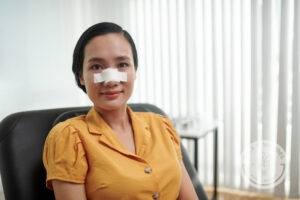 Young woman with bandage across bridge of nose following nose job