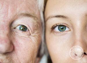 Under Eye Rejuvenation showcase with elder and young lady