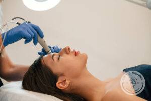 Woman receives microneedling treatment for wrinkle reduction