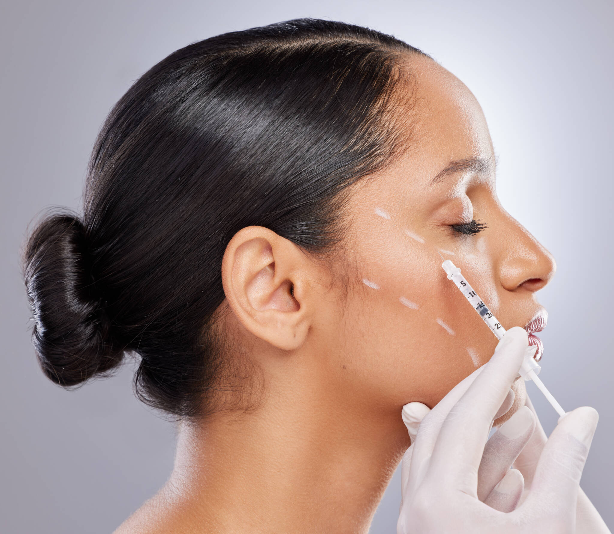 Woman receives injectable neurotoxin to relax facial muscles and reduce the appearance of wrinkles.