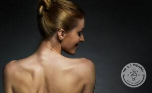 Woman shows the effects of Botox for her neck