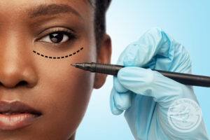 woman having lines for a blepharoplasty drawn