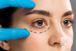 female patient being examined before a nashville blepharoplasty