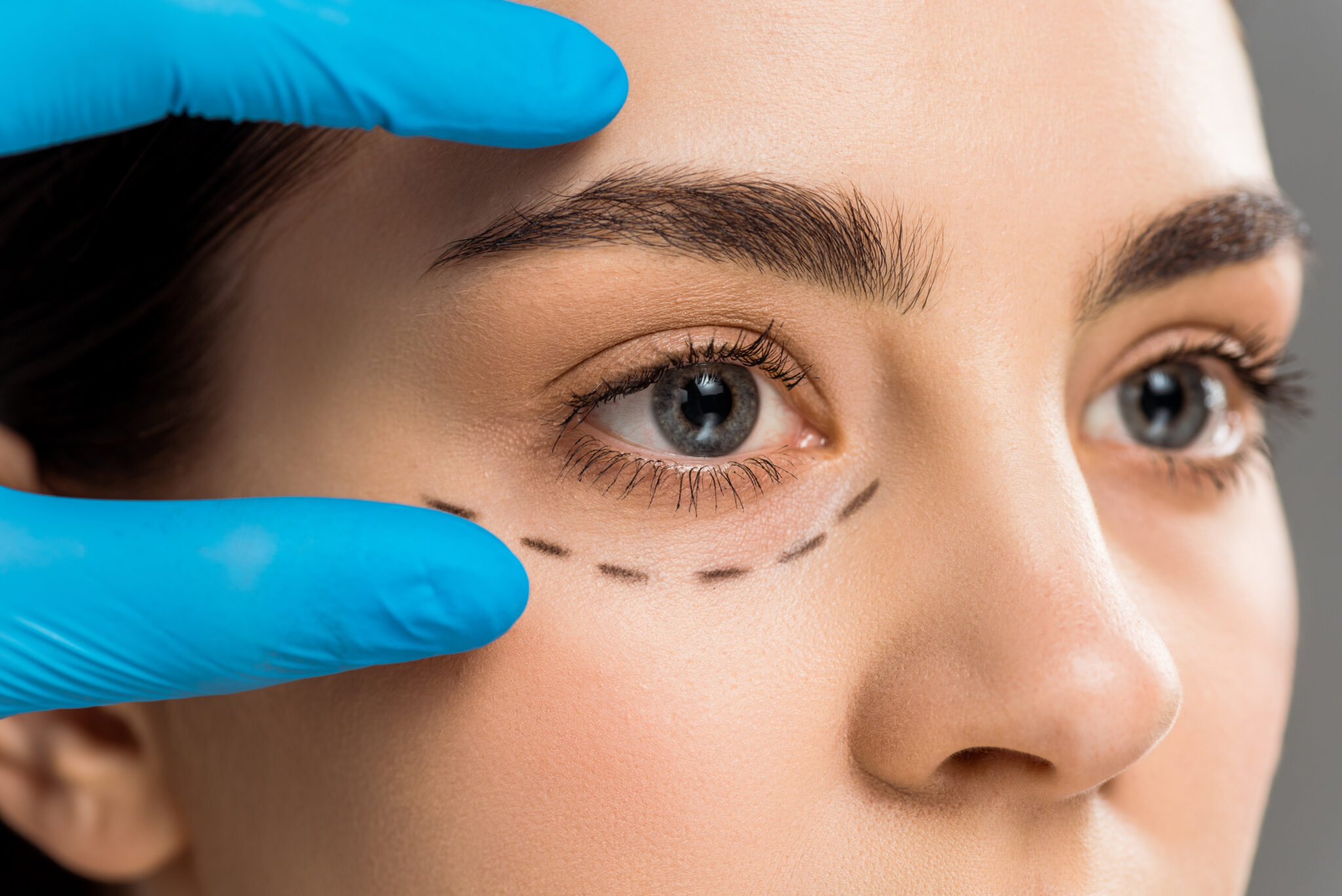 female patient being examined before a nashville blepharoplasty