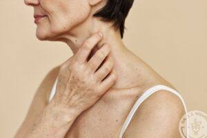 woman experiencing low skin elasticity