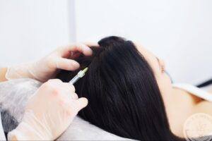 Woman receiving non-surgical hair restoration treatment with scalp injection for hair thinning