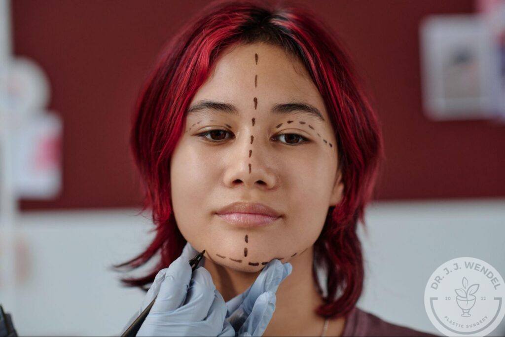 Why More Patients Under 50 Are Choosing Deep Plane Facelifts