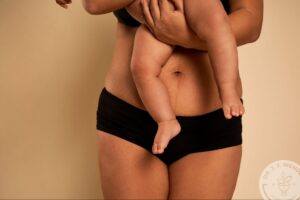Mother holding baby showing postpartum abdomen before mommy makeover procedure